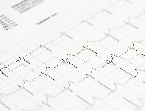 EKG